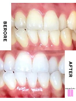 エクシアホワイトニング 王寺店/