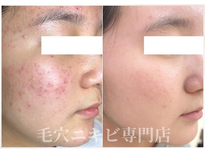 ムク(Muqu.)の写真