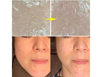 ココリッチ(KoKoRichi)/フェイスラインUP/透明感UP