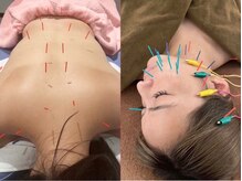 松戸駅前鍼灸院 整骨院