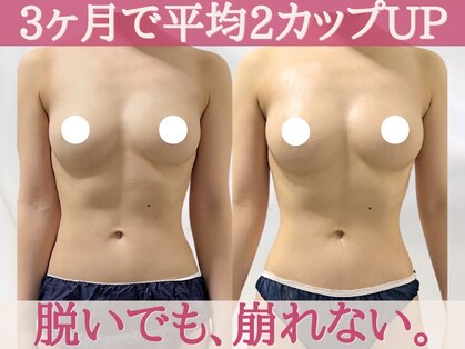 キャンベル(CANBELLE)の写真