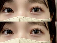 ミーアイラッシュ(ME.eyelash)/LASH LIFT