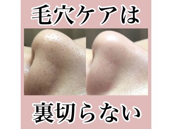 ゴールデンケア(goldencare)/毛穴の悩み諦めないで!