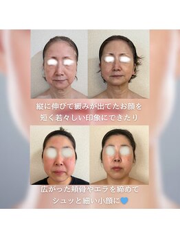 リーブル(LIBRE)/