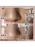 【黒ずみ/皮脂詰まりに】毛穴改善コース(デコルテマッサージ付)100分￥11000