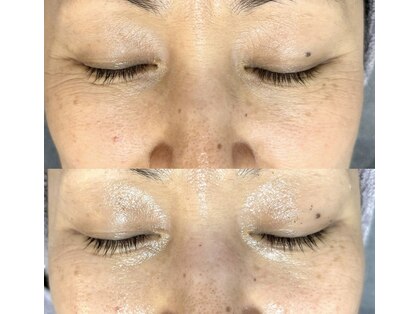 サロン ウルハ(Salon Uruha)の写真