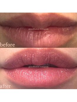 セレア(CELEA)/ローマピンク／リップ&ニップル