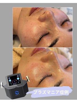 エネイブル(ENable)/