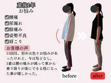 アオラド(Aolado)/腰痛、尿漏れ、姿勢、肩こり