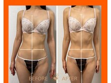 ベルフェム(Bellefemme)/