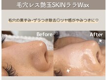 ビオエル(Bioell)の雰囲気（【毛穴レス艶玉SKIN】毛穴レスの艶肌に！！憧れの卵肌へ♪♪）