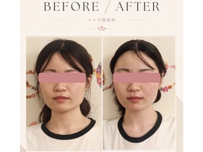 シャインビューティー(ShineBeauty)の写真