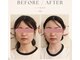 シャインビューティー(ShineBeauty)の写真