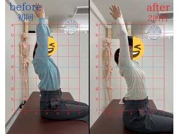 トワニ整体 新富町院(TOWANI整体)/寝付き/銀座/新富町/築地/整体