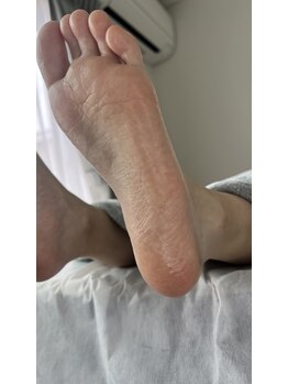 フットミー(foot mii)/