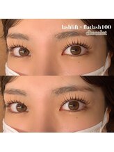 アイラ 甲府昭和店(EYELA)/リフエク100本