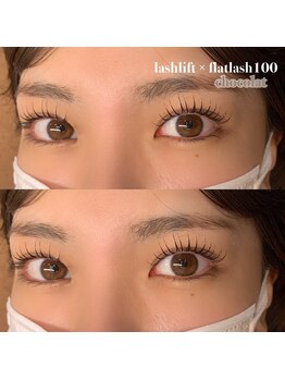 アイラ 甲府昭和店(EYELA)/リフエク100本