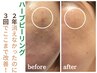 ハーブピーリング＋高濃度美容液導入 60分￥15,400→