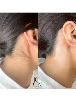 アイコン(iCON)/うなじWax