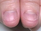 深爪専門だからできること