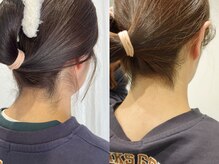 シロ(Shiro)/うなじのデザイン脱毛