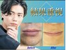 6月限定!!【青髭解消！★髭剃り卒業！】ヒゲ脱毛1回体験¥2980→¥980