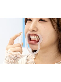 美白ケアをしたい