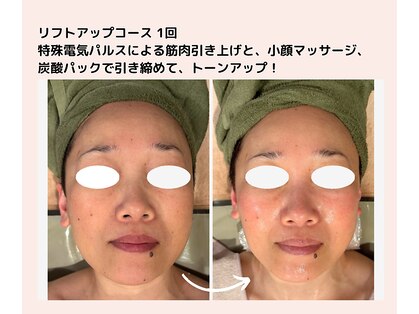 アマテ(Amate)の写真