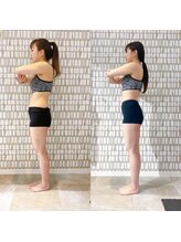 イーストレッチジム 新宿(E-STRETCH GYM)/ビフォーアフター