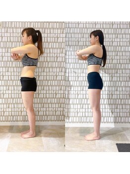 イーストレッチジム 新宿(E-STRETCH GYM)/ビフォーアフター