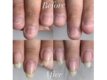 ロイヤル ネイルサロン(Royal nail Saloon)の雰囲気（育成に特化した技術で健康な美爪へ…最短3ヶ月で変化がわかる）