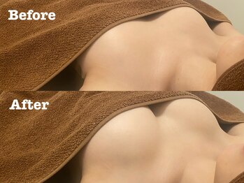 整顔整頭の写真/理想のバストラインへ導く！下垂・左右差ケアで、憧れのバストアップを叶えませんか？★