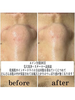 ジョルフ サロン オリジナル(JOLF salon original)の写真/話題のEIEN導入！分子レベルの極小スチーム＆毛穴洗浄で肌質改善◇透き通る潤いツヤ肌へ導く個室サロン
