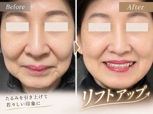 ココスタイルビューティー(COCOSTYLE beauty)