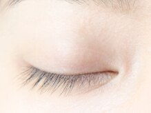 ラウル(Laul by Eye Candy)/施術前 [閉じ] before