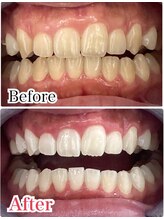 ホワイトニングスタイル 柏店/漂白ジェル使用可能◎歯科提携