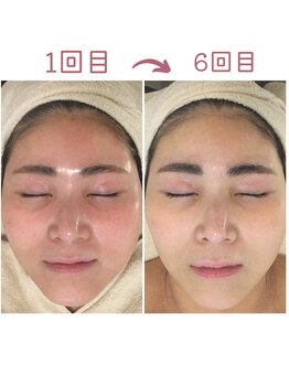 シーフェイス(see face)/赤いのが当たり前を卒業