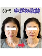 顔凛(カオリン)/ゆがみ改善ならお任せください