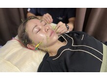 みき接骨院の雰囲気(リフトアップ美容鍼でたるみケア!)