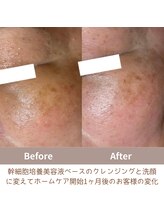 クリニカルスイート エーアール(Clinical sweet.ar)/美肌作りは継続することが大切