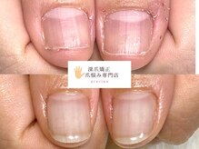 グレースレディ 大阪店/(深爪/長さだし/自爪育成)