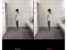 リード整骨院(LEAD整骨院)/姿勢改善、猫背、反り腰