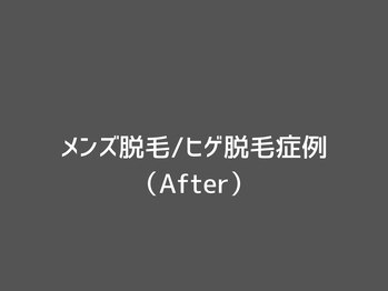 オアシスラグーン(OASIS LAGOON)/メンズ脱毛/ヒゲ脱毛