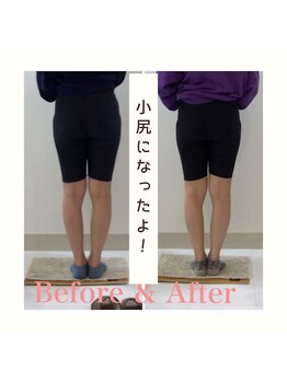 スタイルラボ高松/産後の骨盤矯正の効果♪