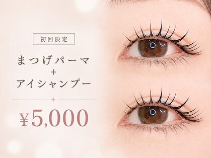 エメル(Emer)の写真