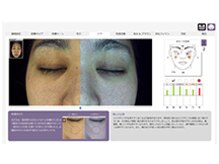 bou 新宿/肌精密検査で本当の肌を知る