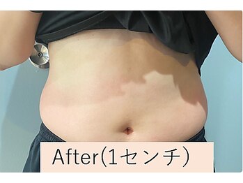 カナウ(kanau)/トリプルボディシェイプ