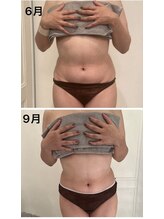 美人バスト 川崎店/【痩身・ダイエット】 腰回り