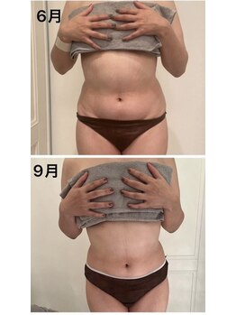 美人バスト 川崎店/【痩身・ダイエット】 腰回り