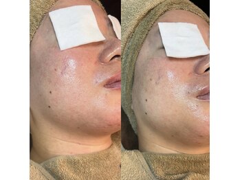 アトレ(Atre)/ゾンビエステ★